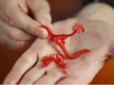 Công nghệ y học cho tương lai:  in 3D vi mạch máu người